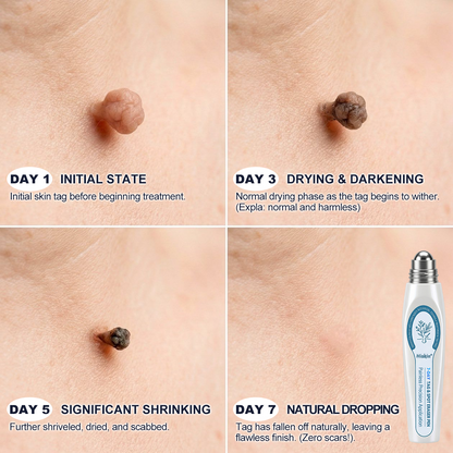 𝐇𝐢𝐬𝐤𝐢𝐧®CareUplift® 🎁ABSOLUTE MADNESS! 50% OFF — EVEN WE CAN’T BELIEVE WE’RE DOING THIS!🎁