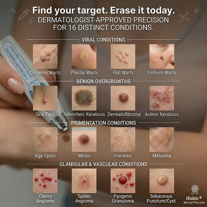 Only 10 left! 🌟 𝐇𝐢𝐬𝐤𝐢𝐧® Wart Removal Roll-On Pen is now 30% off—help reduce the appearance of warts in just 1–3 weeks. Once sold out, it won’t return until next year! 180-day money-back guarantee, completely risk-free.