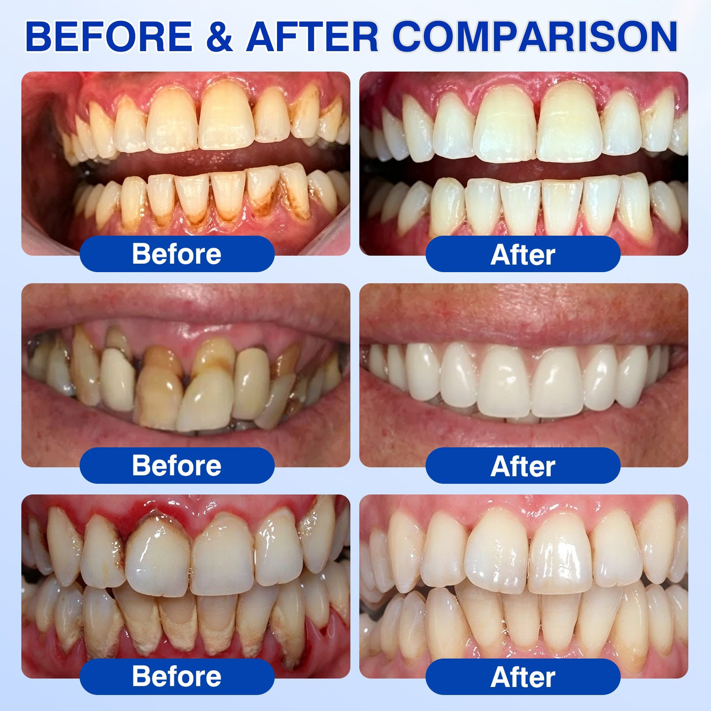 🇺🇸🏅🦷𝐎𝐟𝐟𝐢𝐜𝐢𝐚𝐥 𝐒𝐭𝐨𝐫𝐞 | 𝐏𝐮𝐫𝐚𝐂𝐮𝐫𝐞® 𝐆𝐮𝐦𝐑𝐞𝐯𝐢𝐯𝐞 𝐏𝐞𝐫𝐢𝐨𝐝𝐨𝐧𝐭𝐚𝐥 𝐑𝐞𝐩𝐚𝐢𝐫 𝐆𝐞𝐥 — 𝐓𝐚𝐫𝐠𝐞𝐭𝐞𝐝 𝐆𝐮𝐦𝐥𝐢𝐧𝐞 𝐒𝐮𝐩𝐩𝐨𝐫𝐭 𝐟𝐨𝐫 𝐏𝐥𝐚𝐪𝐮𝐞, 𝐂𝐚𝐯𝐢𝐭𝐢𝐞𝐬, 𝐏𝐞𝐫𝐢𝐨𝐝𝐨𝐧𝐭𝐚𝐥 𝐂𝐨𝐧𝐜𝐞𝐫𝐧𝐬, 𝐁𝐚𝐝 𝐁𝐫𝐞𝐚𝐭𝐡 & 𝐖𝐞𝐚𝐤 𝐓𝐞𝐞𝐭𝐡 | 𝐏𝐫𝐞𝐜𝐢𝐬𝐢𝐨𝐧 𝐋𝐞𝐚𝐯𝐞-𝐎𝐧 𝐎𝐫𝐚𝐥 𝐂𝐚𝐫𝐞 𝐅𝐨𝐫𝐦𝐮𝐥𝐚