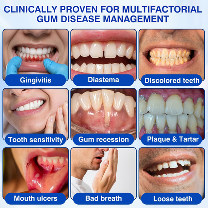🇺🇸🏅🦷𝐎𝐟𝐟𝐢𝐜𝐢𝐚𝐥 𝐒𝐭𝐨𝐫𝐞 | 𝐏𝐮𝐫𝐚𝐂𝐮𝐫𝐞® 𝐆𝐮𝐦𝐑𝐞𝐯𝐢𝐯𝐞 𝐏𝐞𝐫𝐢𝐨𝐝𝐨𝐧𝐭𝐚𝐥 𝐑𝐞𝐩𝐚𝐢𝐫 𝐆𝐞𝐥 — 𝐓𝐚𝐫𝐠𝐞𝐭𝐞𝐝 𝐆𝐮𝐦𝐥𝐢𝐧𝐞 𝐒𝐮𝐩𝐩𝐨𝐫𝐭 𝐟𝐨𝐫 𝐏𝐥𝐚𝐪𝐮𝐞, 𝐂𝐚𝐯𝐢𝐭𝐢𝐞𝐬, 𝐏𝐞𝐫𝐢𝐨𝐝𝐨𝐧𝐭𝐚𝐥 𝐂𝐨𝐧𝐜𝐞𝐫𝐧𝐬, 𝐁𝐚𝐝 𝐁𝐫𝐞𝐚𝐭𝐡 & 𝐖𝐞𝐚𝐤 𝐓𝐞𝐞𝐭𝐡 | 𝐏𝐫𝐞𝐜𝐢𝐬𝐢𝐨𝐧 𝐋𝐞𝐚𝐯𝐞-𝐎𝐧 𝐎𝐫𝐚𝐥 𝐂𝐚𝐫𝐞 𝐅𝐨𝐫𝐦𝐮𝐥𝐚
