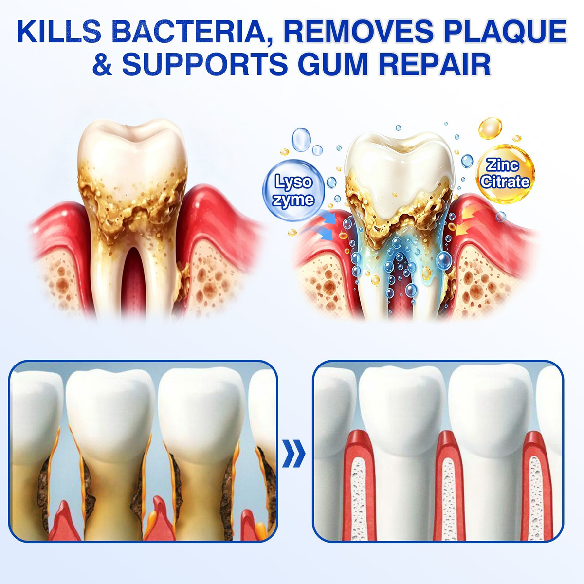🇺🇸🏅🦷𝐎𝐟𝐟𝐢𝐜𝐢𝐚𝐥 𝐒𝐭𝐨𝐫𝐞 | 𝐏𝐮𝐫𝐚𝐂𝐮𝐫𝐞® 𝐆𝐮𝐦𝐑𝐞𝐯𝐢𝐯𝐞 𝐏𝐞𝐫𝐢𝐨𝐝𝐨𝐧𝐭𝐚𝐥 𝐑𝐞𝐩𝐚𝐢𝐫 𝐆𝐞𝐥 — 𝐓𝐚𝐫𝐠𝐞𝐭𝐞𝐝 𝐆𝐮𝐦𝐥𝐢𝐧𝐞 𝐒𝐮𝐩𝐩𝐨𝐫𝐭 𝐟𝐨𝐫 𝐏𝐥𝐚𝐪𝐮𝐞, 𝐂𝐚𝐯𝐢𝐭𝐢𝐞𝐬, 𝐏𝐞𝐫𝐢𝐨𝐝𝐨𝐧𝐭𝐚𝐥 𝐂𝐨𝐧𝐜𝐞𝐫𝐧𝐬, 𝐁𝐚𝐝 𝐁𝐫𝐞𝐚𝐭𝐡 & 𝐖𝐞𝐚𝐤 𝐓𝐞𝐞𝐭𝐡 | 𝐏𝐫𝐞𝐜𝐢𝐬𝐢𝐨𝐧 𝐋𝐞𝐚𝐯𝐞-𝐎𝐧 𝐎𝐫𝐚𝐥 𝐂𝐚𝐫𝐞 𝐅𝐨𝐫𝐦𝐮𝐥𝐚