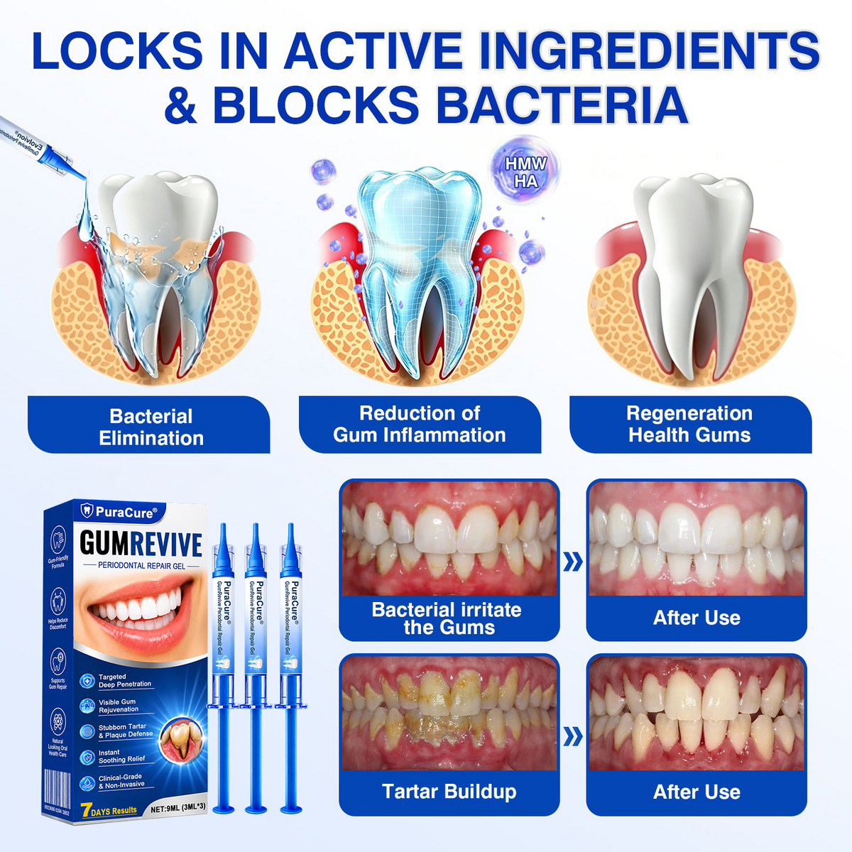 🇺🇸🏅🦷𝐎𝐟𝐟𝐢𝐜𝐢𝐚𝐥 𝐒𝐭𝐨𝐫𝐞 | 𝐏𝐮𝐫𝐚𝐂𝐮𝐫𝐞® 𝐆𝐮𝐦𝐑𝐞𝐯𝐢𝐯𝐞 𝐏𝐞𝐫𝐢𝐨𝐝𝐨𝐧𝐭𝐚𝐥 𝐑𝐞𝐩𝐚𝐢𝐫 𝐆𝐞𝐥 — 𝐓𝐚𝐫𝐠𝐞𝐭𝐞𝐝 𝐆𝐮𝐦𝐥𝐢𝐧𝐞 𝐒𝐮𝐩𝐩𝐨𝐫𝐭 𝐟𝐨𝐫 𝐏𝐥𝐚𝐪𝐮𝐞, 𝐂𝐚𝐯𝐢𝐭𝐢𝐞𝐬, 𝐏𝐞𝐫𝐢𝐨𝐝𝐨𝐧𝐭𝐚𝐥 𝐂𝐨𝐧𝐜𝐞𝐫𝐧𝐬, 𝐁𝐚𝐝 𝐁𝐫𝐞𝐚𝐭𝐡 & 𝐖𝐞𝐚𝐤 𝐓𝐞𝐞𝐭𝐡 | 𝐏𝐫𝐞𝐜𝐢𝐬𝐢𝐨𝐧 𝐋𝐞𝐚𝐯𝐞-𝐎𝐧 𝐎𝐫𝐚𝐥 𝐂𝐚𝐫𝐞 𝐅𝐨𝐫𝐦𝐮𝐥𝐚