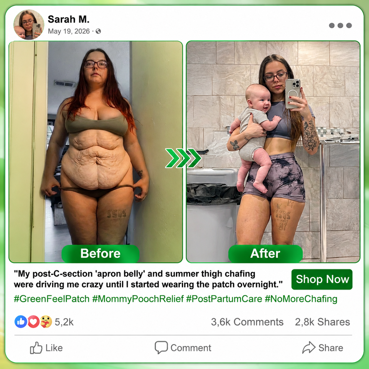 💖⏰Just Today |🇺🇸𝐂𝐚𝐫𝐞𝐔𝐩𝐥𝐢𝐟𝐭®𝑴𝒐𝒓𝒊𝒏𝒈𝗮 · 𝗕𝗲𝗿𝗯𝗲𝗿𝙞𝙣𝙚 × 𝙉𝘼𝐃+ 𝟏𝟎-𝐢𝐧-𝟏 𝗔𝗱𝘃𝗮𝗻𝗰𝙚𝙙 𝙉𝙖𝙣𝙤 𝙈𝙞𝙘𝙧𝙤𝙣𝙚𝙚𝐝𝐥𝐞 𝐏𝐚𝐭𝙘𝙝(𝐉𝐮𝐬𝐭 𝐨𝐧𝐜𝐞 𝐚 𝐝𝐚𝐲, 𝐯𝐢𝐬𝐢𝐛𝐥𝐞 𝐜𝐡𝐚𝐧𝐠𝐞𝐬 𝐢𝐧 𝟕 𝐝𝐚𝐲𝐬） ✅ 𝐅𝐨𝐫 𝐨𝐛𝐞𝐬𝐢𝐭𝐲, 🅛🅞🅞🅢🅔 🅢🅚🅘🅝,𝐝𝐢𝐚𝐛𝐞𝐭𝐞𝐬, 𝐬𝐥𝐞𝐞𝐩 𝐚𝐩𝐧𝐞𝐚, 𝐣𝐨𝐢𝐧𝐭 𝐢𝐬𝐬𝐮𝐞𝐬, 𝐚𝐧𝐝 𝐦𝐨𝐫𝐞💯💯
